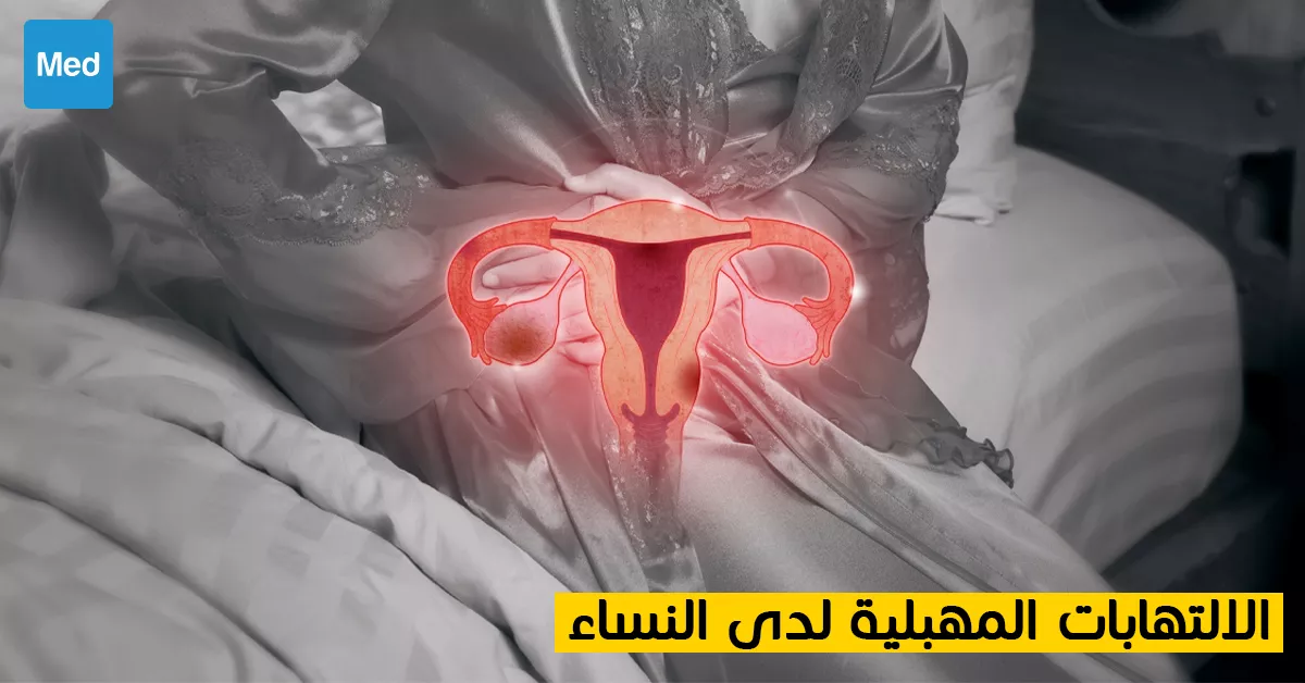 الالتهابات المهبلية لدى النساء